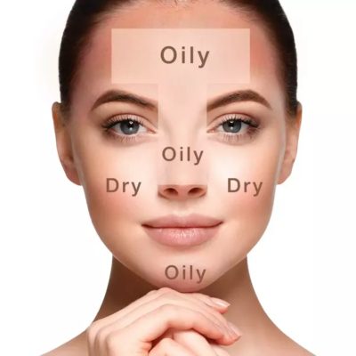 What Is an Oily Skin Type and How to Tell If You Have It